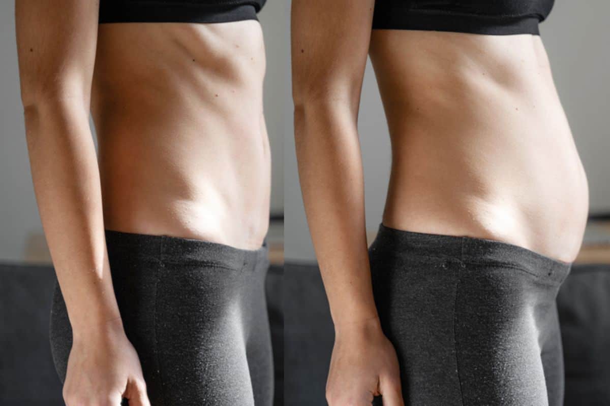 How long does diastasis recti take to improve Shepherd's Bush?