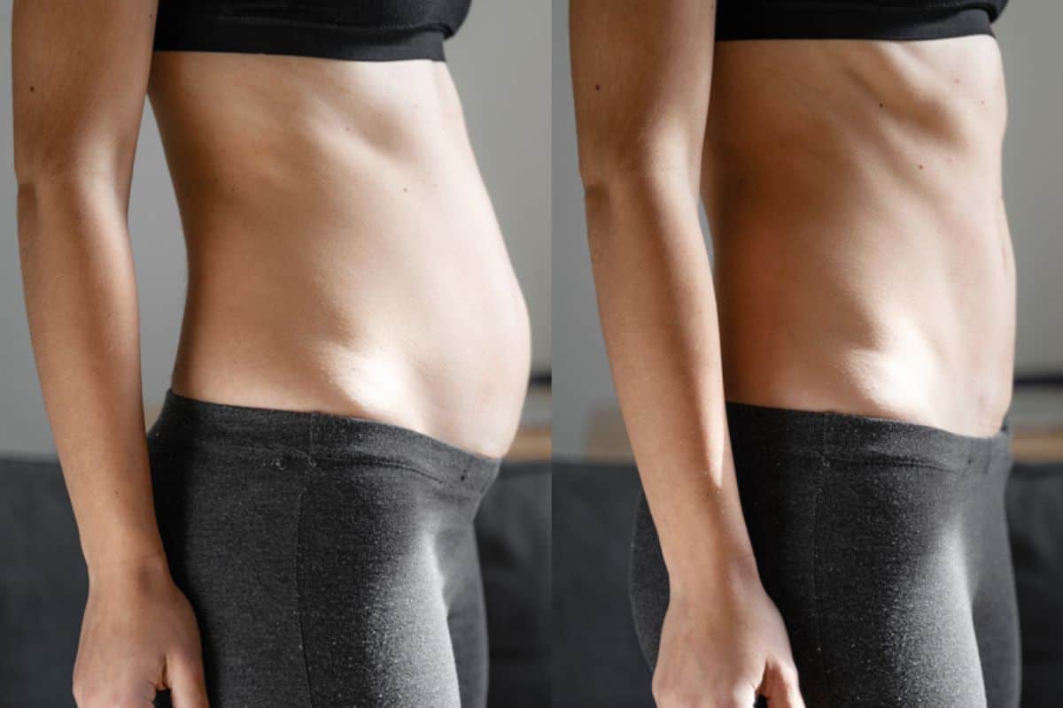 Post-Pregnancy: What Happens to Your Abdominal Muscles After Birth Shepherd's Bush
