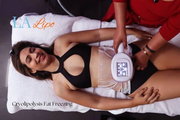 woman getting cryolipolysis Shepherd's Bush