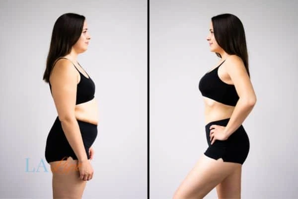LA-EMS Body Sculpting Shepherd's Bush results before and after of womans results on body toning.