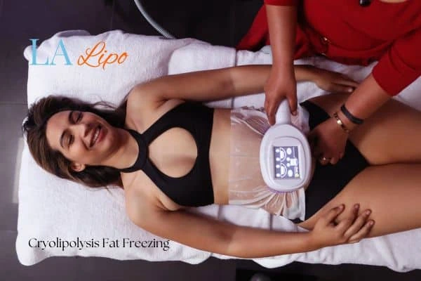 woman getting cryolipolysis Shepherd's Bush