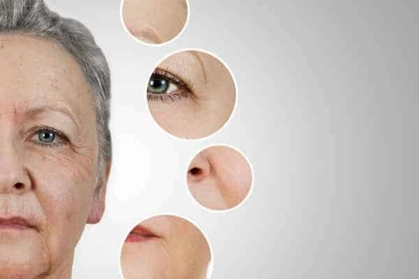 HIFU Facelift Shepherd's Bush from LA LIPO