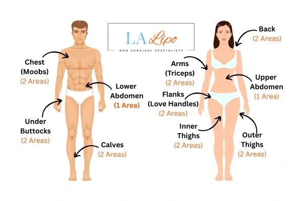 LA LIPO Cryolipolysis Areas Shepherd's Bush