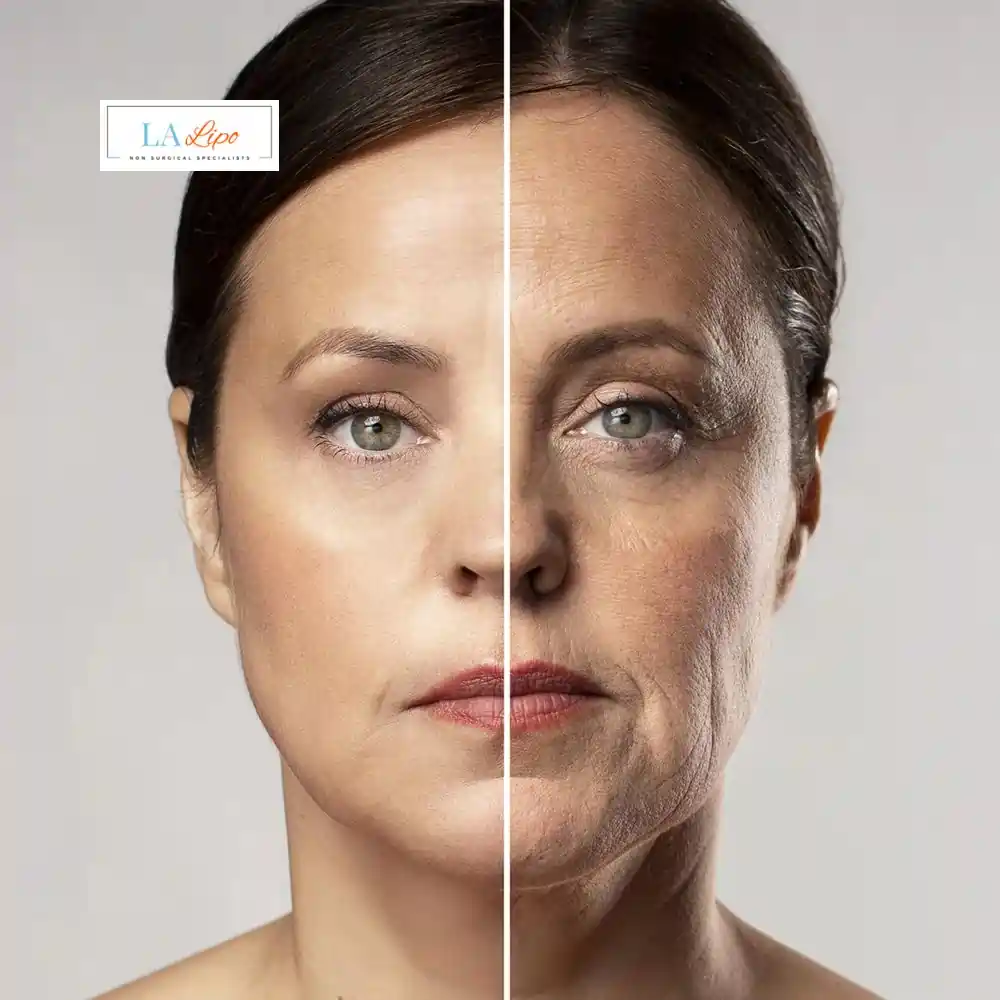 How Can You Tell If Non-Surgical Skin Tightening Is Right for You Shepherd's Bush?