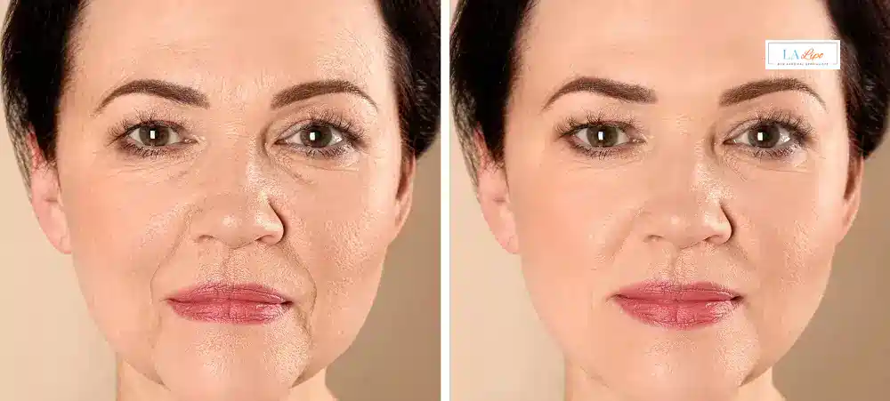How Long Does It Take to See Results and How Long Do They Last Shepherd's Bush?
