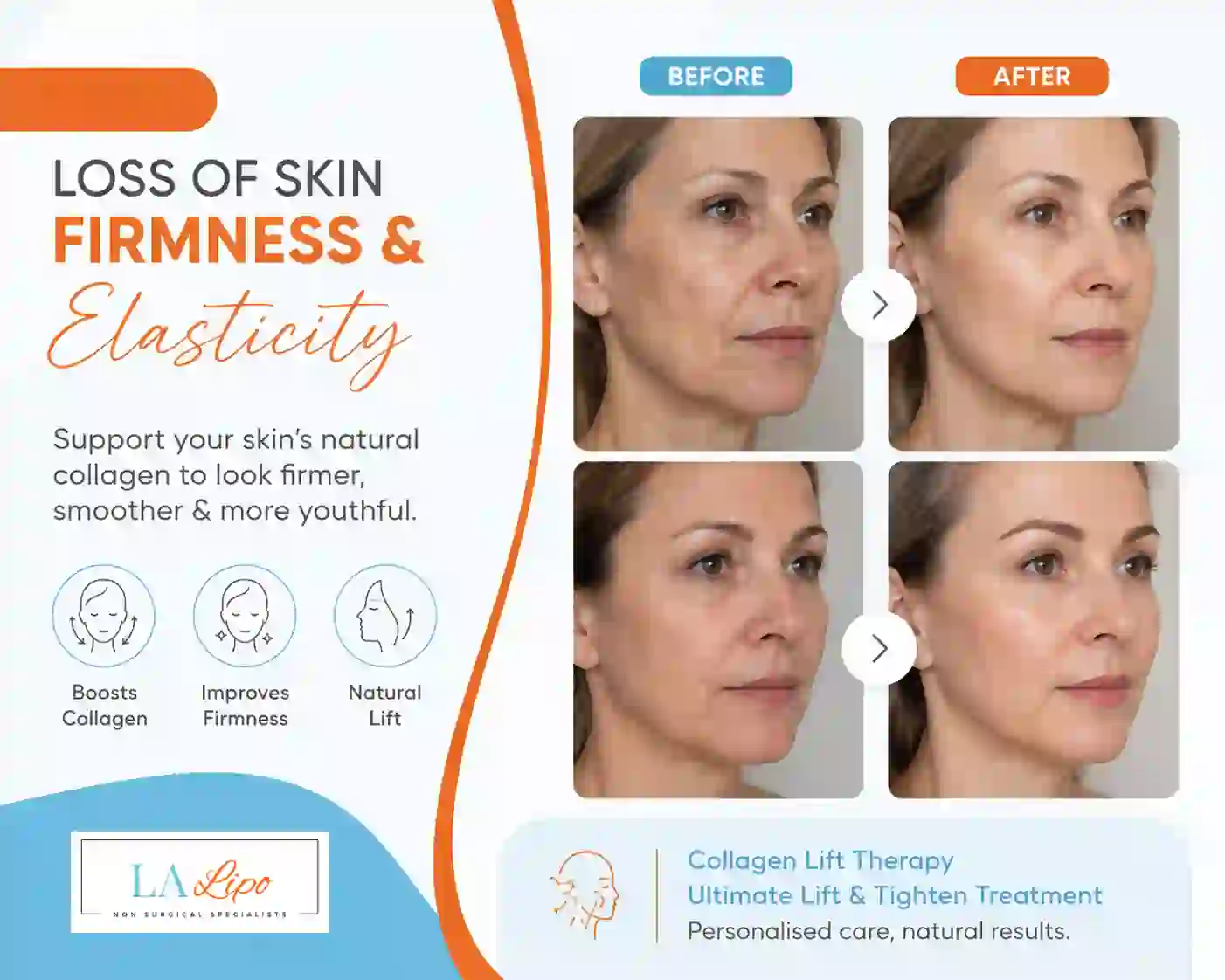 Sign #7: Loss of Skin Firmness and Elasticity Shepherd's Bush