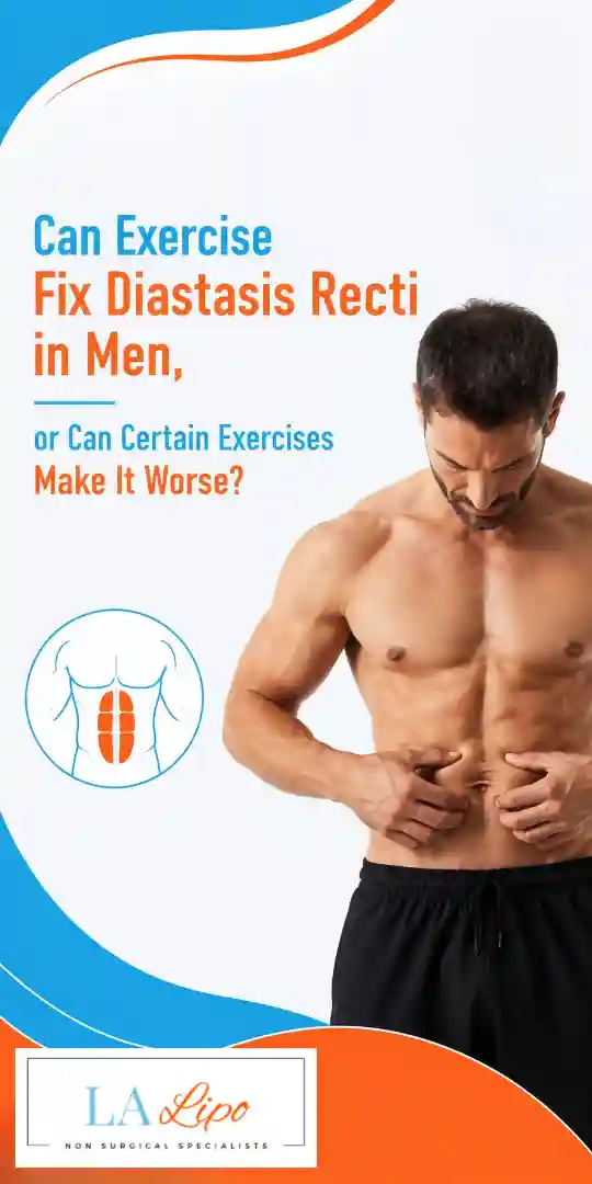Can Exercise Fix Diastasis Recti in Men, or Can Certain Exercises Make It Worse Shepherd's Bush?